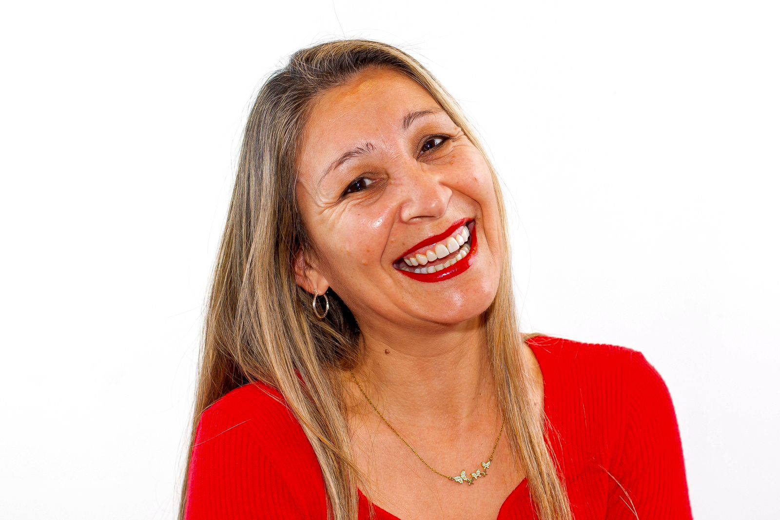 Caso Premium Smile — Odontología Arana